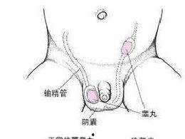 儿童隐睾图片大全,早期识别与治疗关键
