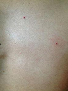 手背上有小红点图片,探寻健康密码