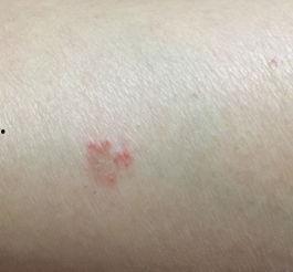 手背上有小红点图片,探寻健康密码