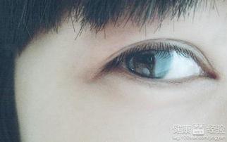 眼睛黄斑病图片,视觉健康危机的影像解析