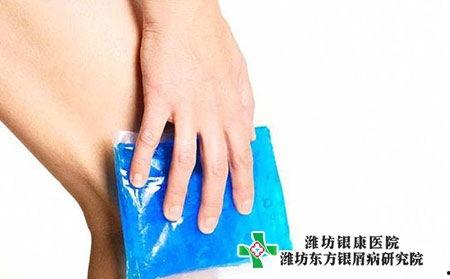 皮肤癣图片,图片揭示常见真菌感染特征