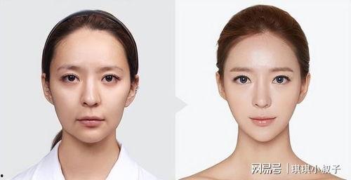 悬胆鼻图片,揭秘面部美学新焦点