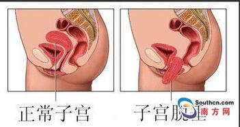 正常人的宫颈图片,正常宫颈的形态与特征解析
